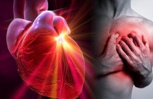 Cardioxil vélemények, fórum, hozzászólások